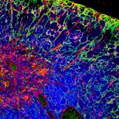 análisis por inmunofluorescencia y microscopía confocal de una sección de timo, el órgano donde se generan los linfocitos T