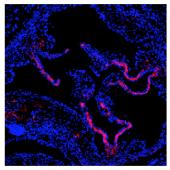 En busca de anticuerpos como dianas terapéuticas para la aterosclerosis