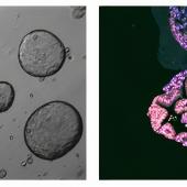 Regeneración de células beta del páncreas a partir de progenitores endógenos