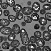 Pseudomona putida en la que se puede ver la heterogeneidad poblacional en cuanto a la producción de bioplástico. Unos individuos tienen (gránulos blancos) y otros no.